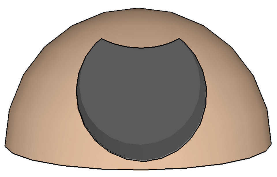 Unique shape — 300’ diameter limit