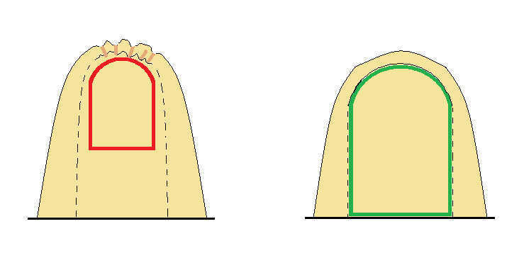 Head-on view of inflated augment showing seaming and (interior) buck placement — Left Image:  Multiple wrinkles and valleys pull into the augment crown due to buck placement well inside of the seaming and interior air pressure.  Once foamed these become hardend channels that direct rain run-off behind your window trim.  The buck was made 1.5" larger than the hypothetical window on all sides.
  Right Image:  The buck should be sized to fit just inside of the vertical plane and Airform seaming of the augment.  Hence, crowns, valleys and wrinkles are minimized.  The shape is taut.  The window framers will have ample room to install or retro-fit new window technology years later.  Rain run-off is also improved to roll off the sides of the augment.