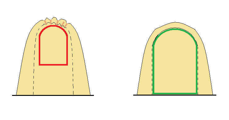 Head-on view of inflated augment showing seaming and (interior) buck placement — Left Image:  Multiple wrinkles and valleys pull into the augment crown due to buck placement well inside of the seaming and interior air pressure.  Once foamed these become hardend channels that direct rain run-off behind your window trim.  The buck was made 1.5" larger than the hypothetical window on all sides.
Right Image:  The buck should be sized to fit just inside of the vertical plane and Airform seaming of the augment.  Hence, crowns, valleys and wrinkles are minimized.  The shape is taut.  The window framers will have ample room to install or retro-fit new window technology years later.  Rain run-off is also improved to roll off the sides of the augment.